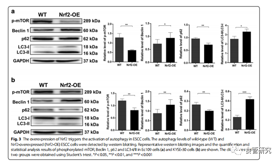 Nrf2通过CaMKIIα相关的自噬激活促进食管鳞状细胞癌对放射治疗的抗性