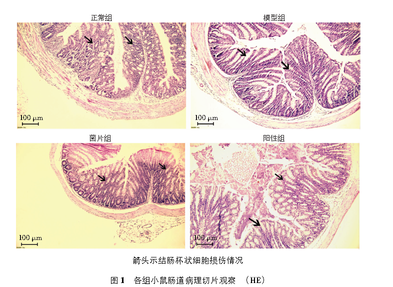 【文献速递】复方嗜酸乳杆菌片对便秘的治疗作用及对肠道菌群的影响