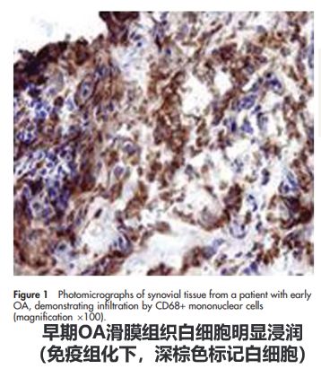 如何优化膝骨关节炎的抗炎药物治疗？