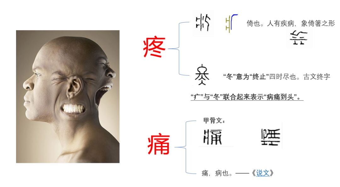 对话疼痛科——正视疼痛治疗