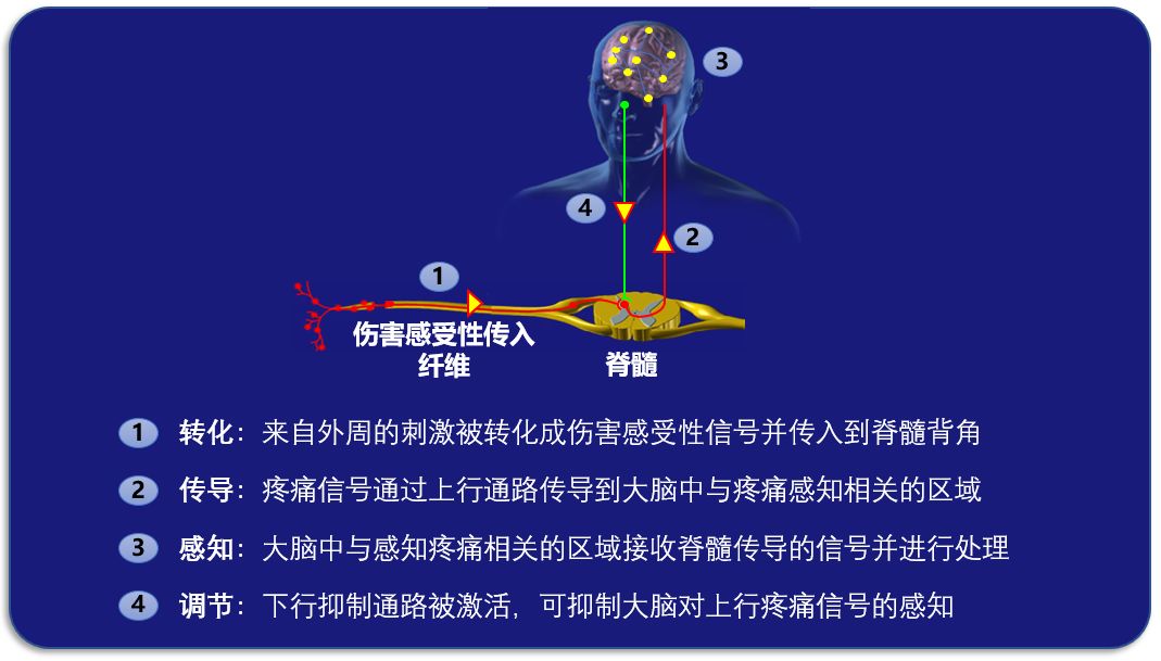 对话疼痛科——正视疼痛治疗