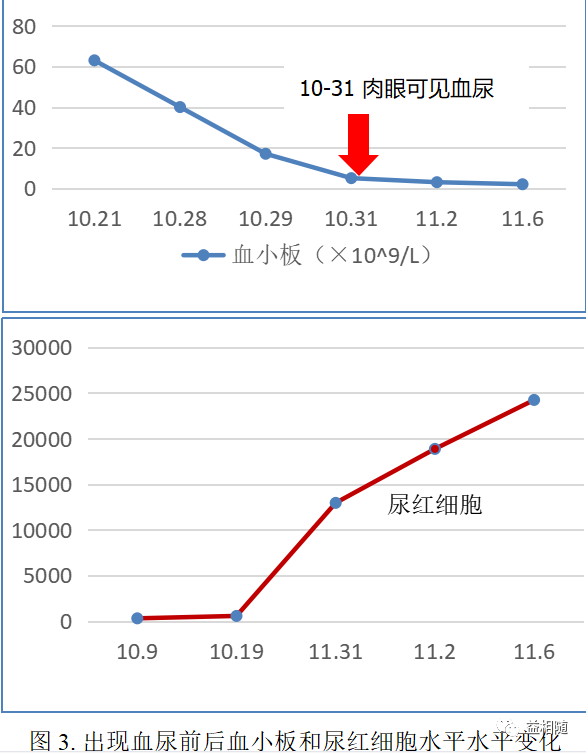 多发性骨髓瘤合并复杂感染一例——曲折救治之路