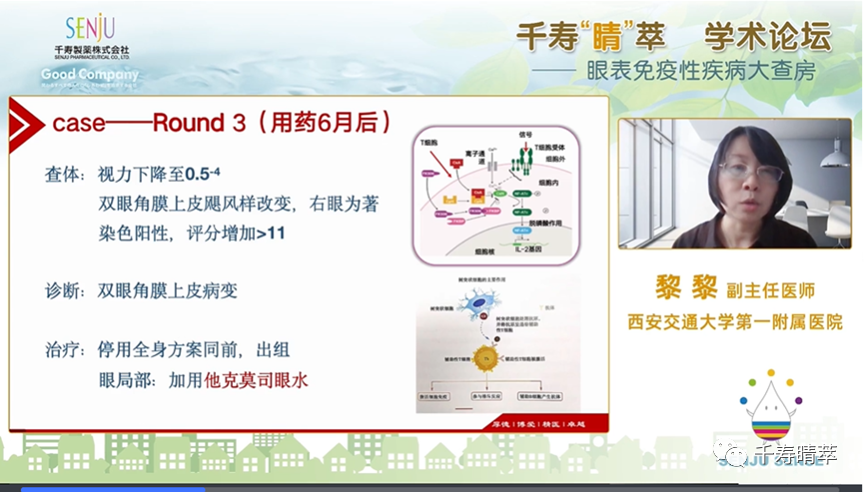 直播回看：千寿‘晴’萃 学术论坛——眼表免疫性疾病大查房