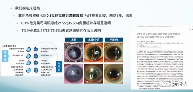 直播回看|千寿“睛”萃学术论坛--眼表超适应症用药及相关指南解读