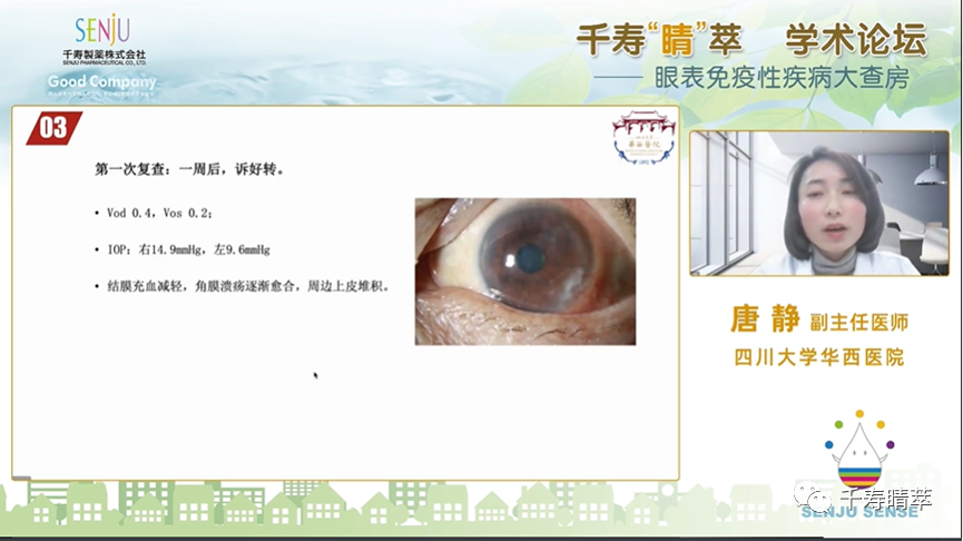 直播回看：千寿‘晴’萃 学术论坛——眼表免疫性疾病大查房