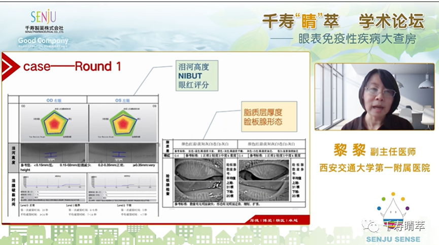 直播回看：千寿‘晴’萃 学术论坛——眼表免疫性疾病大查房