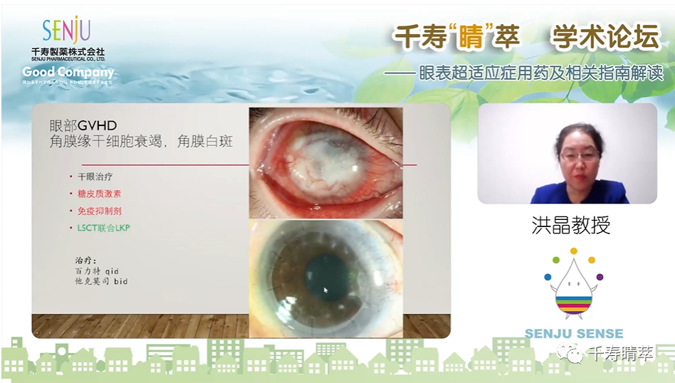 直播回看|千寿“睛”萃学术论坛--眼表超适应症用药及相关指南解读