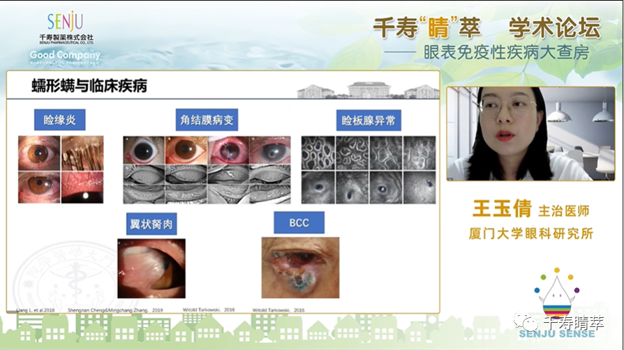 直播回看：千寿‘晴’萃 学术论坛——眼表免疫性疾病大查房