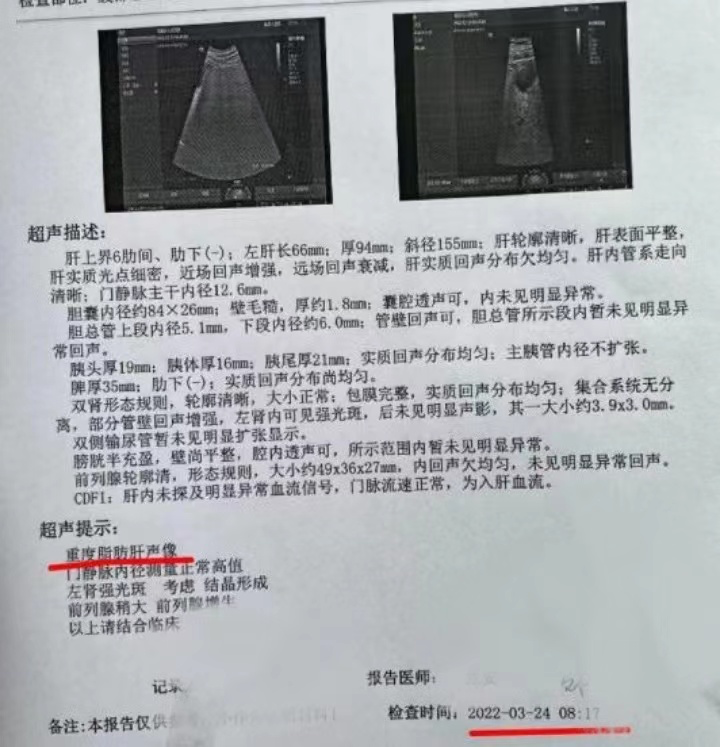 2 型糖尿病合并 NAFLD 治疗太棘手，不妨试试这个方案