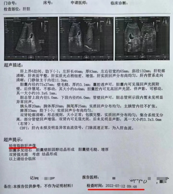 2 型糖尿病合并 NAFLD 治疗太棘手，不妨试试这个方案