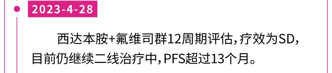 【好西例】HDACi西达本胺+氟维司群用于一线CDK4/6i进展后病例分享