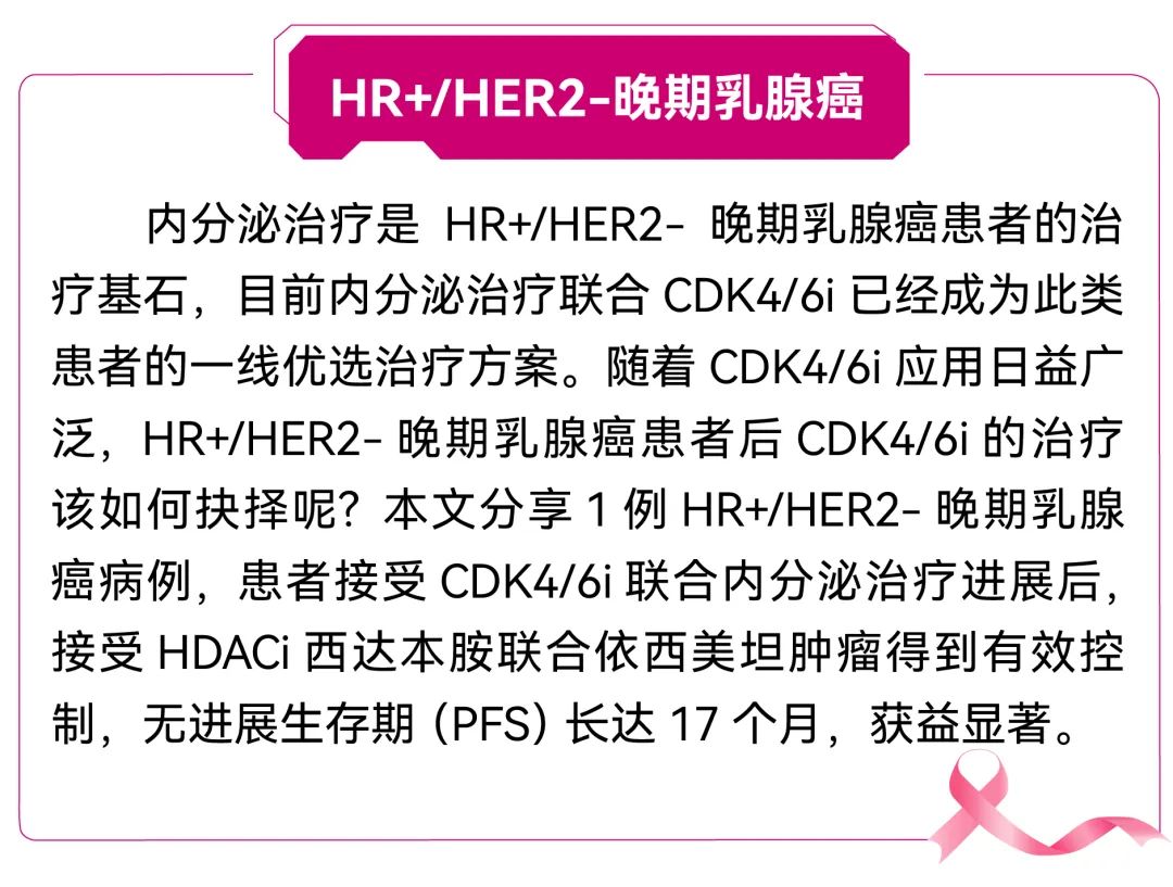 【好西例】PFS大于17个月!西达本胺联合内分泌为CDK4/6i经治患者带来显著获益