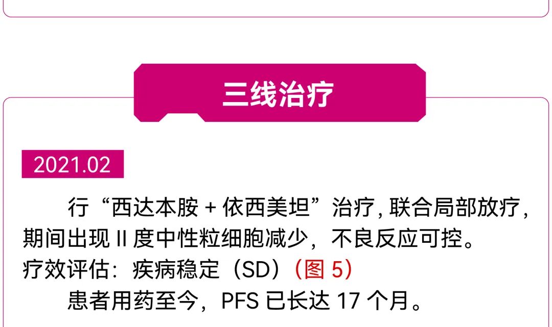 【好西例】PFS大于17个月!西达本胺联合内分泌为CDK4/6i经治患者带来显著获益