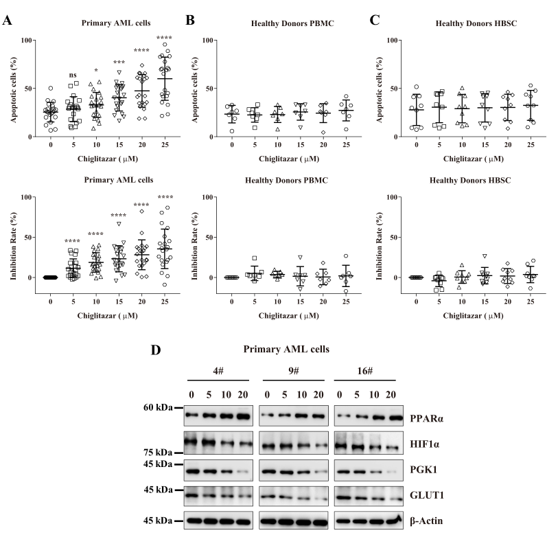 徐兵教授：PPARα-HIF1α-PGK1 信号通路有望成为治疗AML干祖细胞的新靶点