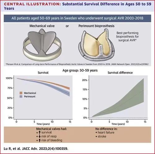 文献速递｜50 至 69 岁患者的主动脉瓣置换：机械瓣膜对比 Perimount 生物瓣膜